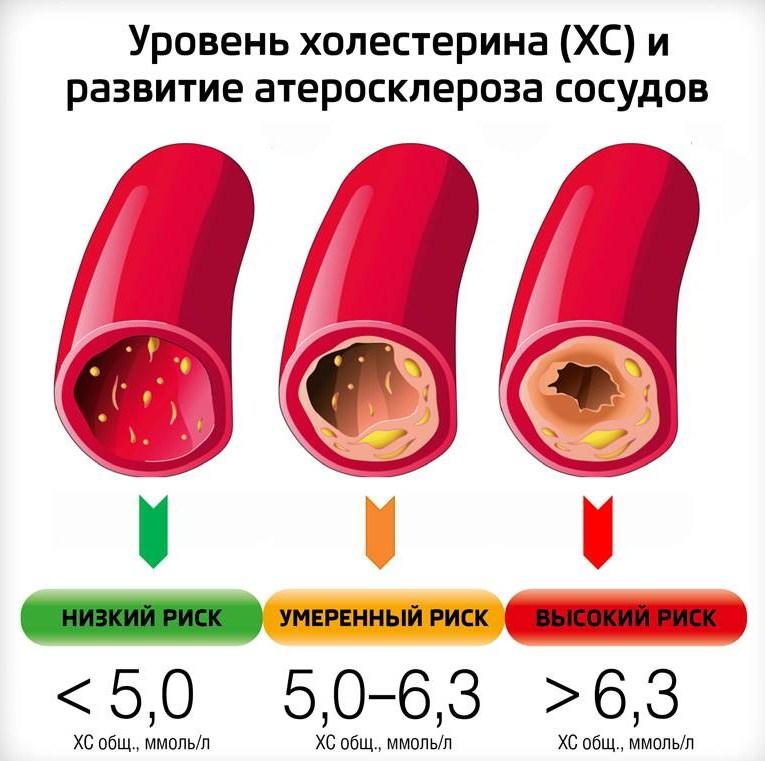 Какие продукты употребляют для снижения холестерина: лучшие рецепты
